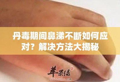 丹毒期间鼻涕不断如何应对?解决方法大揭秘
