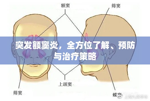 突发额窦炎，全方位了解、预防与治疗策略